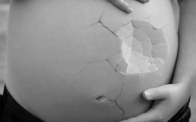 Tekenen van een miskraam in het eerste trimester