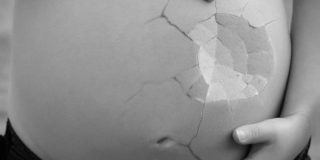 Tekenen van een miskraam tijdens het eerste trimester van de zwangerschap